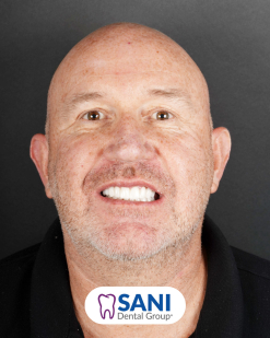 After from Justin Fish